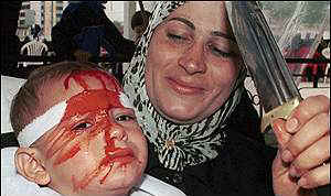 A mother rejoices after inflicting wounds on the head of her toddler in service to "Allah"
